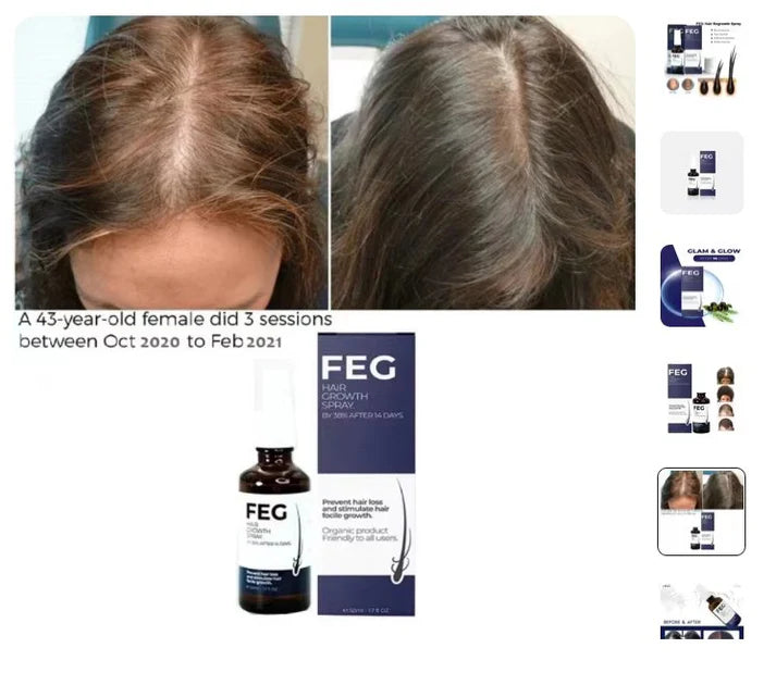 HairBloom™ Advanced Hair Growth Spray – Stronger, Fuller Hair Naturally