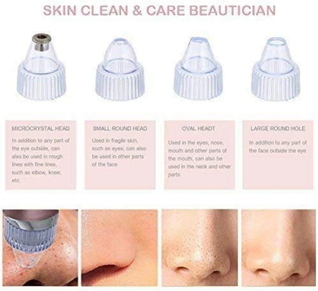 UltraSuction™ Facial Pore Cleaner – For Clear & Smooth Skin